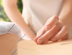 Indications for medical acupuncture.ent