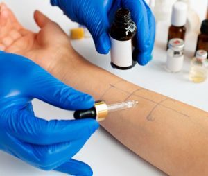 Allergy Tests for Allergen Identification.ent