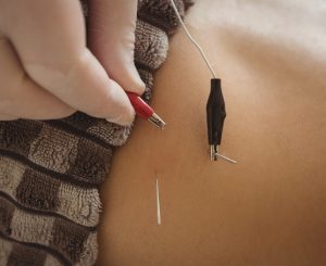 Αντιμετώπιση του τοπικού πάχους με βελονισμό.ent