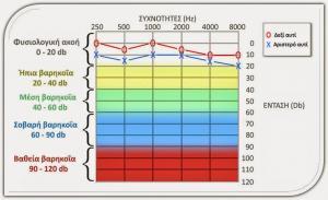 Αιτίες Βαρηκοίας και εντόπιση βλάβης.ent