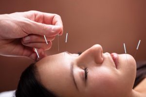 Acupuncture.ent