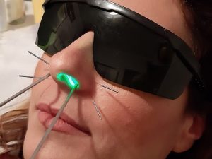 EY-LLLT treatment for Nasal Polyps.ent