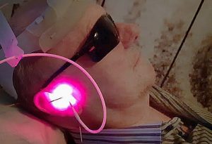 Tinnitus Management at EYiasis. ent